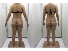 リッツ 所沢店/【Before/After】痩身
