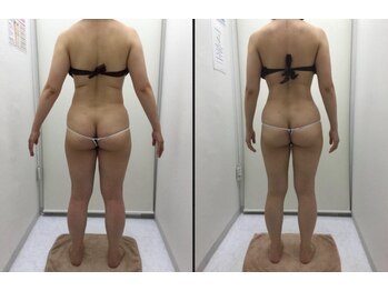 リッツ 所沢店/【Before/After】痩身