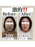 [小顔/ヘッド]小顔整顔&ヘッドマッサージお手軽コース♪　40分　