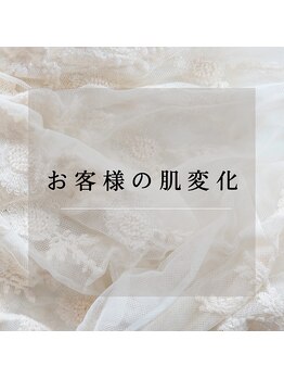 サロン ド エン(Salon de. en)/お客様達のお肌変化