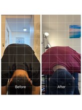 整体院札希 宝塚店(さつき)/【背骨ゆがみ改善】