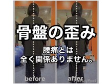 カワル整体 上通り院/腰痛とは一切関係ありません。
