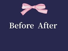 エレミュー 烏丸(Elemue.)/【スタッフ藤田 施術症例】