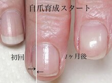 トゥインクリーネイルサロン(Twinkly Nail Salon)/【最強のネイルケア】1回お試し