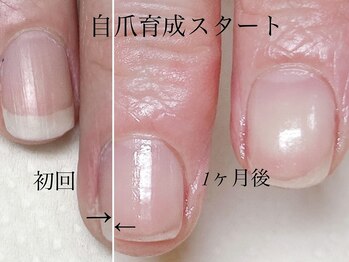 トゥインクリーネイルサロン(Twinkly Nail Salon)/【最強のネイルケア】1回お試し