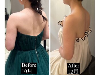 ラトナ(Ratna)/6回ブライダル痩身