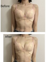 チュラ 大宮店(Chura)/肩位置激変→谷間も激変（3/4）