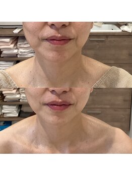 ビューティーサロン セガール(segar)/レッドショットフェイス