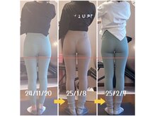 美尻のための矯正×ストレッチサロンPONO FIT.【ポノフィット】/症例／ヒップ