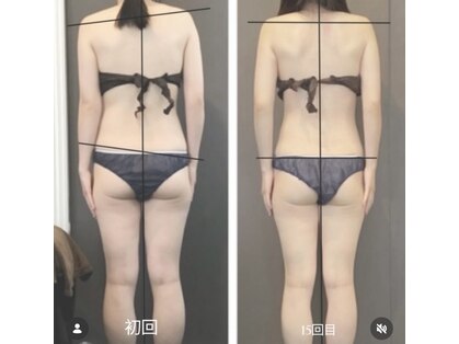 リリー(Lily)の写真