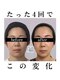 キュープ 大阪心斎橋店(Qpu)の写真/小顔頭蓋骨矯正と美肌美顔器が導く。美顔器と美容液で理想を叶える体験!