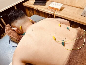 チルタイム(Chill Time)/鍼に通電します！