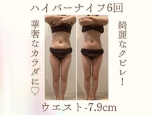 フォーユー マシバメディカル(For You Mashiba Medical)/ウエスト－7.9センチ☆　２０代