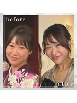 ヨサパーク デイジー(YOSA PARK Daisy)/痩身/ダイエット/リンパ/毛穴