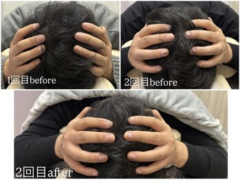 サロン ド グレース(Salon de Grace)/【桑名小顔矯正】メンズも変化