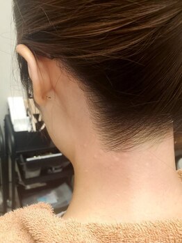 ユメバンチ(yumebanchi)の写真/今すぐツルスベにしたい方必見☆当店人気のワックス脱毛×光脱毛の《Ｗ脱毛》でパーツごとに綺麗を実現♪