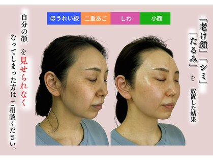 モモラ(Spa MoMora)の写真