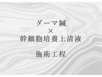 整骨院トリデ(整骨院TORIDE)/ダーマ鍼×幹細胞 施術工程