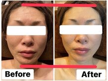 イオム ビューティワーク(IOM BEAUTY WORK)/