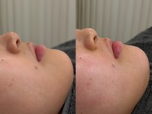 ラキ(LAKI)/フェイシャルワックス