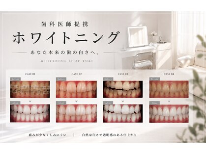 ホワイトニングショップ 土岐店の写真