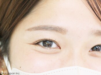 グルス(GRUS)/Wプロテクトカール