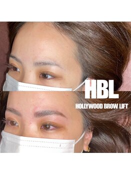 クーラ(CURA)/《HBL》ハリウッドブロウリフト