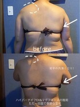 優来 神田店/肩甲骨施術の例