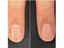 ウォーク(Walk)/★ 美爪ウォーターケア 