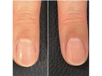 ★ 美爪ウォーターケア 