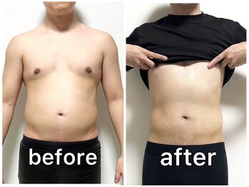 サンク(Cinq)/整体と骨盤矯正と腸もみ施術変化