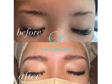 シャロンドットエイチエム(CHALON.HM)/アイブロウリフト