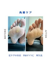 ピーアンドオー(P&O)/角質ケア