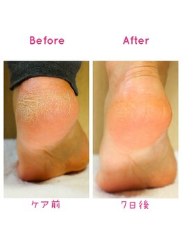 プニュ(Peau nue)/オリジナルスクラブの効果