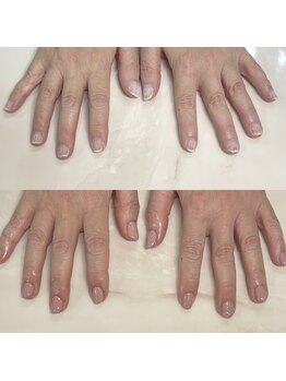 ハッカネイル(HAKKA NAIL)/