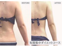 ルミア 函館店(LuMia)/激痩せ短期集中ダイエットコース