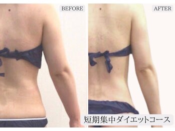 ルミア 函館店(LuMia)/激痩せ短期集中ダイエットコース