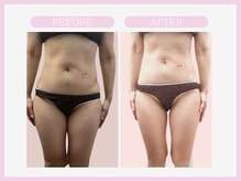 アコガレコガオ 山形店/