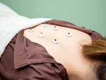 鍼灸サロン咲(ショウ)