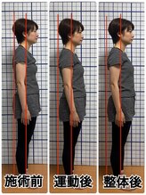 幸鍼灸整体院 武庫之荘院/整体・トレーニング・姿勢変化19