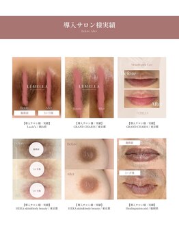 プリマプリート 大垣店/韓国発黒ずみケア【ルメラ】