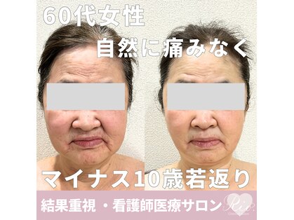 小顔たるみ毛穴専門看護師 クリニカルサロン Rio【3月上旬OPEN（予定）】の写真