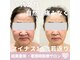 小顔たるみ毛穴専門看護師 クリニカルサロン Rio【3月上旬OPEN（予定）】の写真