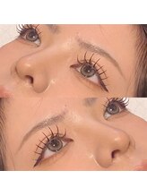 アノネ(anone)/ラッシュリフト