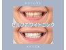【メンズエステ】×【セルフホワイトニング】歯の黄ばみ/汚れ/5回¥16,500→