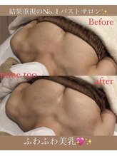 マイントゥー(mine too)/美乳になれる☆