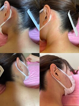 笑顔 上野店/うなじ脱毛