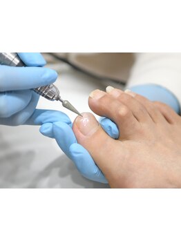 爪の悩みを解消できる（ケア含む）