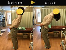 杉本接骨鍼灸院/背骨から全身がユルユル整体