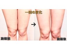 まどかの雰囲気（結果の出る痩身マッサージ！一回の変化に笑顔になります！）